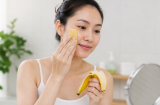 Chà vỏ chuối lên mặt có giúp xóa nhăn như botox? Chuyên gia da liễu đưa ra câu trả lời