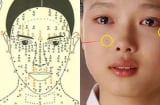 3 nốt ruồi hao tài khánh kiệt nên hóa giải