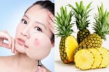 Dứa mang đến nhiều lợi ích cho làn da, từ dưỡng ẩm đến hỗ trợ chống lão hóa