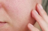 Lỗ chân lông trông nhỏ hơn nhờ quy trình chăm sóc da chỉ với 4 bước cơ bản