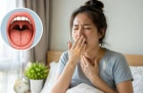 Ngủ dậy thấy khô miệng hãy chú ý điều này