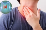 5 dấu hiệu u tuyến giáp đang âm thầm phát triển, nhiều người bỏ qua