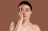 Kem chấm mụn có thực sự hiệu quả? Cách chọn và sử dụng đúng để mụn nhanh phục hồi