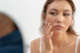 5 thói quen tưởng vô hại nhưng có thể khiến làn da khó bật tông