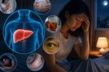 Những dấu hiệu buổi tối cảnh báo gan đang yếu dần, chớ chủ quan