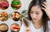 Rụng tóc nhiều là đnag thiếu chất gì?