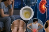 Những dấu hiệu xuất hiện vào buổi tối có thể cảnh báo vấn đề ở thận nhưng nhiều người vẫn bỏ qua