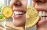 3 cách dùng chanh giúp hơi thở thơm hơn, nhưng có 1 cách nhiều người đang làm khiến men răng bị hại