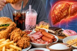 Thói quen ăn uống gây hại gan