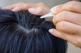 Nhổ tóc bạc, tóc sâu cho đỡ ngứa, coi chừng 4 tác hại khôn lường