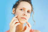 6 dấu hiệu trên khuôn mặt cho thấy bạn đang mang bệnh trong người