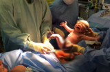 Video bé trai tự bò ra khỏi bụng mẹ giữa ca sinh khiến bác sĩ bất ngờ