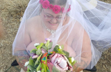 Kỳ lạ: Cô gái bị bệnh vi khuẩn ăn thịt người tỉnh dậy làm đám cưới 'nude'