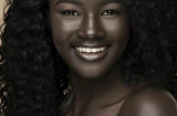 Cận cảnh cô gái da đen xinh đẹp nhất thế giới với là da kỳ lạ 'có 1 không 2'