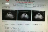 Bé gái Việt Nam 12 tuổi mang thai tại Trung Quốc: Hé lộ có đường dây buôn người đứng sau sự việc