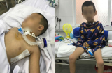Bác sĩ chia sẻ hành trình giành lại sự sống cho bé trai 5 tuổi té ngã gần đứt lìa cổ họng