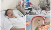 Thoát khỏi bàn tay tử thần, bệnh nhân chia sẻ lý do hỏng gan mật, nhiều người Việt cũng đang mắc
