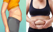 3 kiểu béo bụng không phải do tăng cân mà là lời ngầm báo căn bệnh rất dễ mắc phải