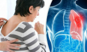 5 dấu hiệu cảnh báo phổi đang bị tấn công, thường bị nhiều người bỏ qua mà không biết