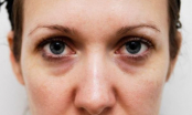 Muốn biết tử cung khỏe hay yếu, phụ nữ nhìn vào 4 điểm này trên khuôn mặt sẽ rõ
