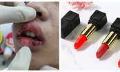 Nữ sinh rỉ máu môi vì mua son trên mạng: BS da liễu khuyên 8 món mỹ phẩm không nên mua