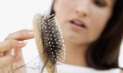 Rụng tóc hóa ra không phải do thiếu chất mà do dư thừa loại vitamin này
