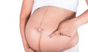 Mang thai có 4 bộ phận chuyển màu càng thâm đen chứng tỏ thai nhi khỏe mạnh, IQ cao