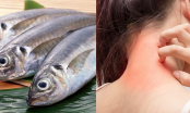 Cá rất bổ nhưng 5 nhóm người này ăn vào có thể làm sức khỏe tồi tệ hơn: Hãy cẩn trọng!
