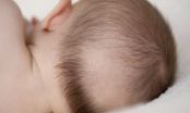 Trẻ nhỏ bị rụng tóc có phải do còi xương hay không? Cách khắc phục đúng nhất mà cha mẹ nên làm