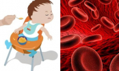 Trẻ thiếu máu rất nguy hiểm, nếu thấy con có 5 biểu hiện này cha mẹ không được chủ quan