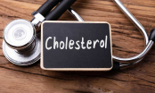 Thừa cholesterol gây bệnh lý về tim mạch, áp dụng ngay 4 chế độ ăn giúp giảm cholesterol xấu