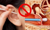 ‘Vạch trần’ 5 nguyên nhân gây ngứa lỗ tai, số 2 rất nhiều người mắc phải