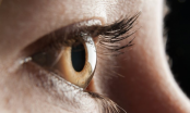 6 điều mắt đang cố gắng cảnh báo với bạn về sức khỏe, đừng bỏ qua