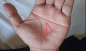Nhìn vào lòng bàn tay: Thấy có hình tam giác đúng chỗ này giàu đến 99%