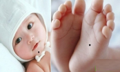 Trẻ có 4 nốt ruồi này trên người cha mẹ tha hồ mừng to: Dự báo phúc khí dồi dào, tương lai sáng chói