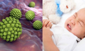 Virus Rota tấn công trẻ em toàn thế giới: BS chỉ ra 8 triệu chứng và 6 cách phòng tránh