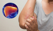 4 vùng trên cơ thể bị đau cảnh báo gan đang nhiễm độc nặng