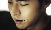 7 nốt ruồi trên khuôn mặt nam giới: Vừa mất thẩm mỹ, vừa khiến vận số lao đao