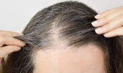 Nhổ tóc bạc 'tưởng không hại nhưng hại không tưởng': BS cảnh báo 5 nguy cơ có thể gặp phải, ai cũng cần biết