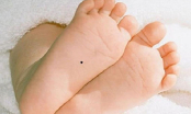 Trẻ có 3 nốt ruồi này trên cơ thể, tương lai rực rỡ, công thành danh toại