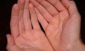 Dù là nam hay nữ, lòng bàn tay có 5 dấu hiệu này thường mang số mệnh phú quý, càng già càng giàu có