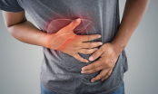 4 vùng trên cơ thể bỗng dưng đau nhói cảnh báo bệnh gan đã đi vào giai đoạn nặng