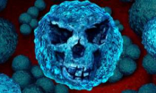Siêu vi khuẩn mới cứ 3s giết chết 1 người, nguy hiểm hơn ung thư