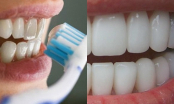 Tỏa sáng mỗi ngày với hàm răng trắng nếu làm theo cách đơn giản này