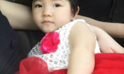 Bất ngờ với hình ảnh bé gái SaPa 14 tháng tuổi nặng 3,5kg lột xác xinh như công chúa