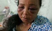 Trần tình của 2 phụ nữ bán tăm bị đánh đến ngất xỉu vì bị nghi bắt cóc trẻ em ở Hà Nội