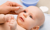 Hướng dẫn cách chăm sóc đôi mắt cho trẻ sơ sinh
