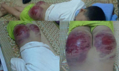 Đang điều tra vụ ông bố đánh đánh con 13 tuổi tứa máu ở Thái Nguyên