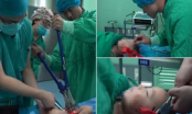 Xót thương: Bé trai bị ô tô đồ chơi găm vào đầu