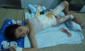 Thương tâm: Trượt chân ngã vào chảo dầu sôi, bé trai 6 tuổi nguy kịch